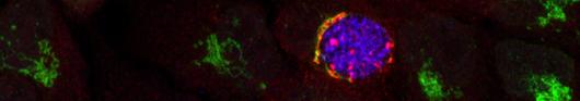 Molecular Microbiology
