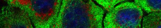 NanoImmunoTech